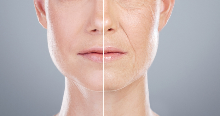 Anti-Ageing