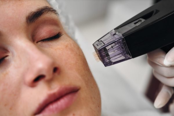 Dermapen & Microneedling – Adamah Clinic